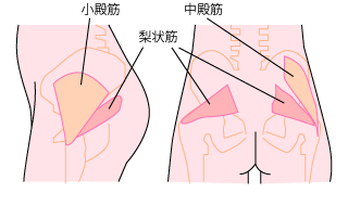 梨状筋症候群の図